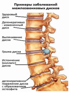 Позвоночник