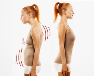 Правильная осанка